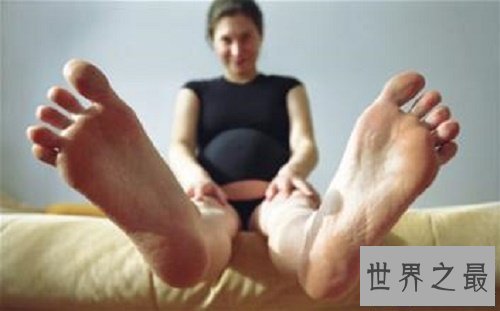 【图】脚气怎样治,水泡型脚气怎样治疗,孕妇得了脚
