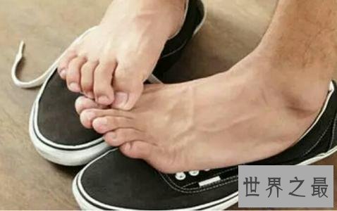 【图】脚气怎样治,水泡型脚气怎样治疗,孕妇得了脚