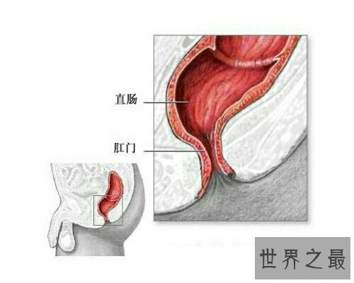 【图】痔疮是一种十分痛苦的疾病 痔疮的症状是什么呢