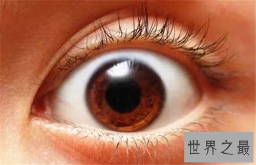 【图】眼睛红血丝是怎样回事 快速消弭红血丝方法