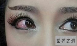 【图】眼睛红血丝是怎么回事 快速消除红血丝方法