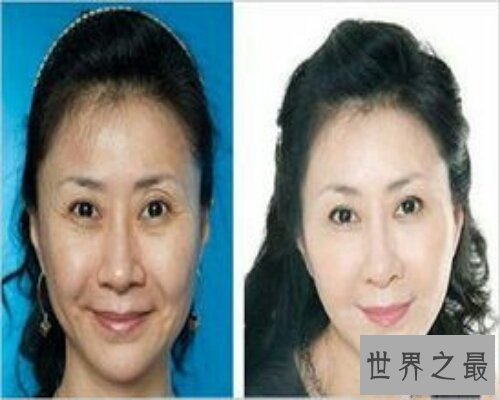 【图】一部言情类小说——老女再嫁，通过了七年之痒
