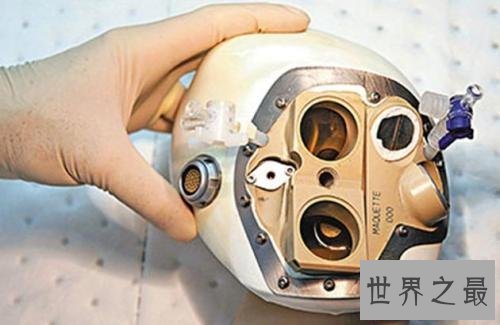 【图】当你的原装心脏出成绩的时分不要怕 还有人工心