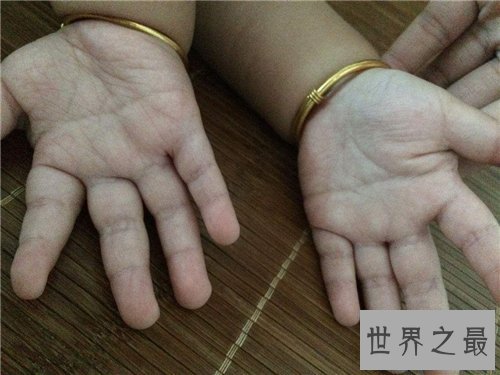【图】断掌纹终身运势如何？男女差异一模一样