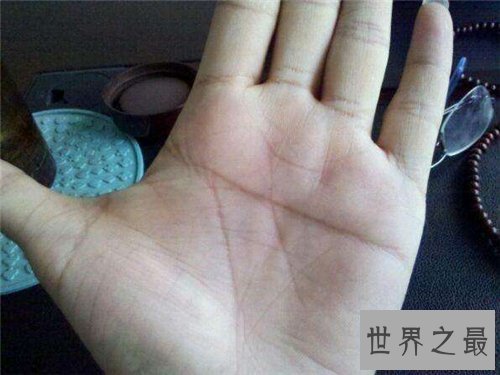 【图】断掌纹终身运势如何？男女差异一模一样