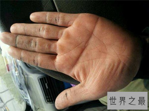 【图】断掌纹终身运势如何？男女差异一模一样