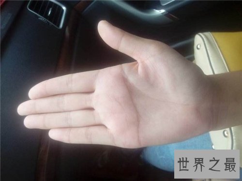 【图】断掌纹终身运势如何？男女差异一模一样