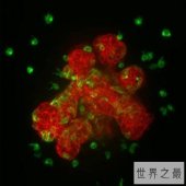 【图】一起来了解关于癌细胞的科普知识，让我们更好