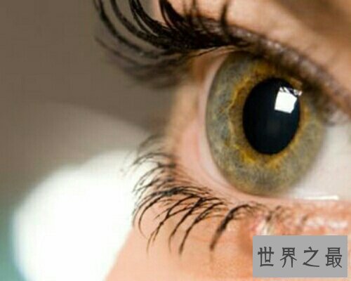 【图】麦粒肿就是咱们俗称的针眼，看一下麦粒肿图片