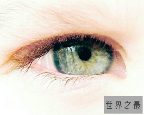 【图】麦粒肿就是咱们俗称的针眼，看一下麦粒肿图片