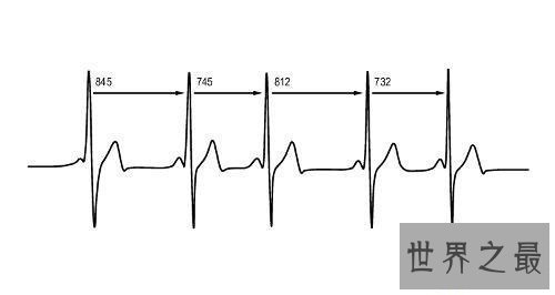【图】失常的血压范围，老年人如何预防高血压，多发