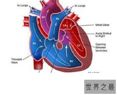 【图】肺心病——了解肺源性心脏病的点点滴滴