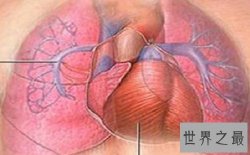 【图】肺心病——了解肺源性心脏病的点点滴滴