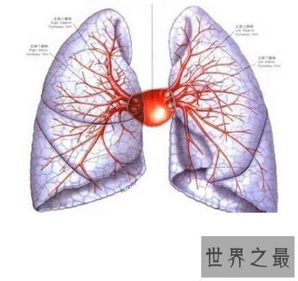 【图】肺纤维化——它会让你的生存不再有色调