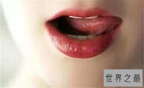 【图】口腔溃疡症状，常常性的口轻溃疡是什么缘由，