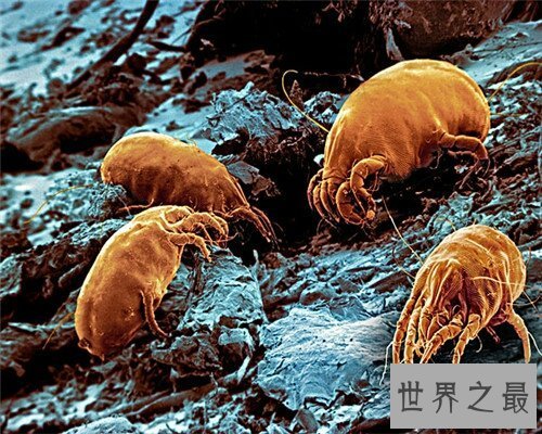 【图】 让咱们来经过螨虫图片来意识螨虫吧