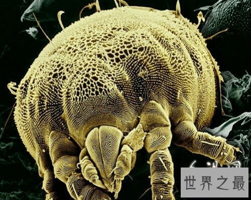 【图】 让咱们来经过螨虫图片来意识螨虫吧