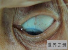 【图】电视上我们经常看到的巫师养的蛊虫真实存在吗