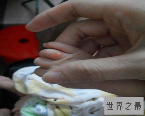 【图】比较常见的生殖系统出现的疾病——疖肿