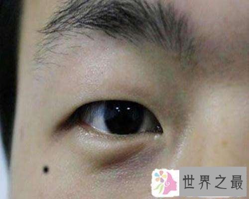 【图】看面相痣图解，了解真正的痣的意义，你知道多