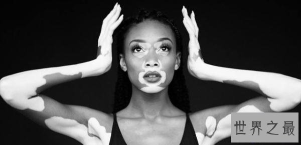 【图】世界上最丑的美女模特,只管丑但丑的性感漂亮