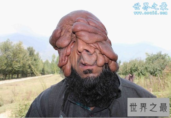 【图】清点世界上最丑的男人，娶2个老婆(生8个孩子)