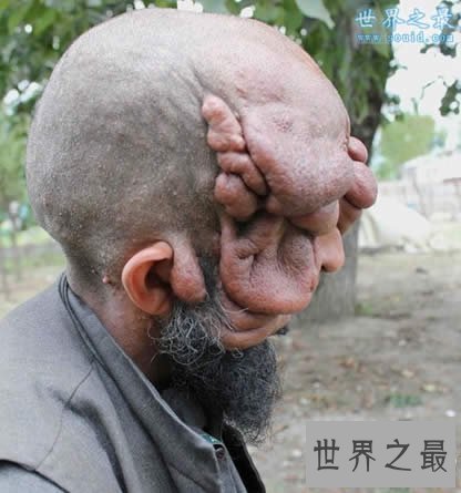 【图】清点世界上最丑的男人，娶2个老婆(生8个孩子)