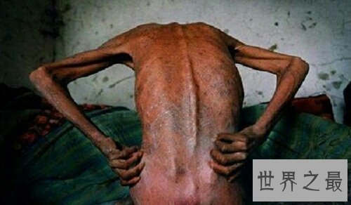 【图】爱护身边的每一个个艾滋病病人,出去看一下吧