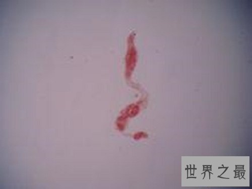 【图】在泛滥嗜血动物中最为恐惧的吸血虫图片