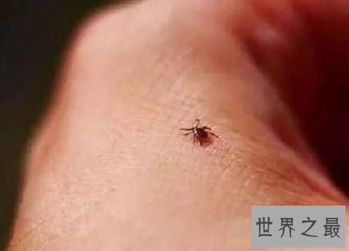【图】在泛滥嗜血动物中最为恐惧的吸血虫图片