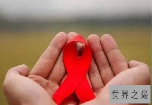 【图】艾滋病初期的症状，他们也是失常人，多点关怀