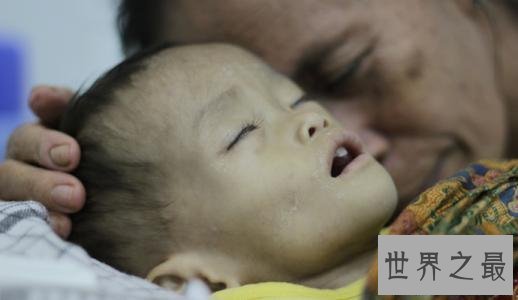 【图】艾滋病初期的症状，他们也是失常人，多点关怀