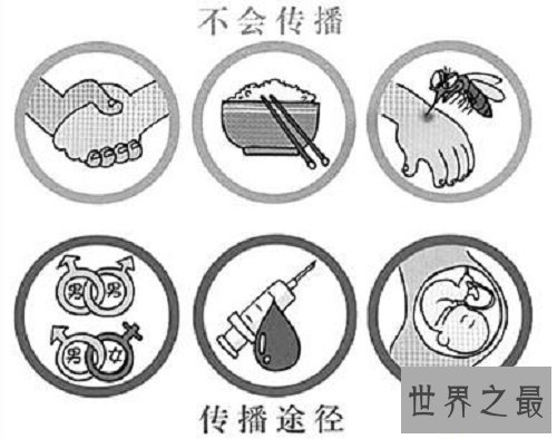 【图】艾滋病初期的症状，他们也是失常人，多点关怀