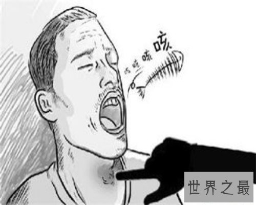 【图】你知道鱼刺卡在喉咙怎样办吗？