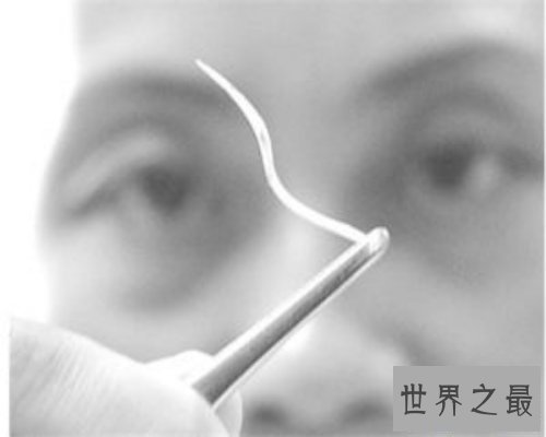 【图】你知道鱼刺卡在喉咙怎样办吗？