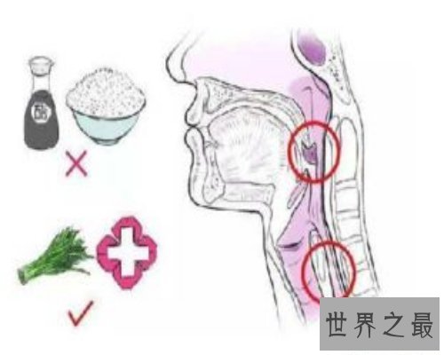 【图】你知道鱼刺卡在喉咙怎样办吗？