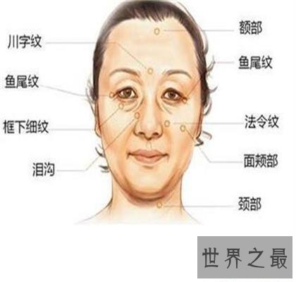 【图】脸上有法令纹怎样办？