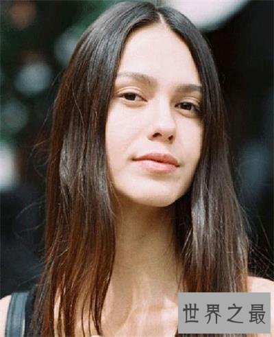 【图】脸上有法令纹怎样办？