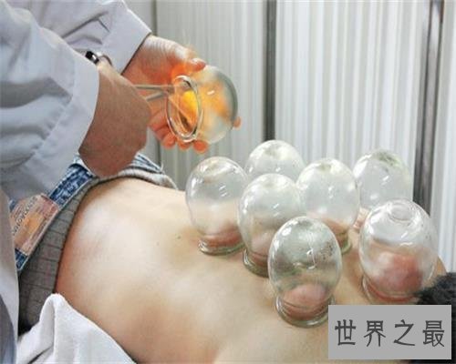 【图】拔罐后皮肤色彩甄别，了解你的瘦弱水平。