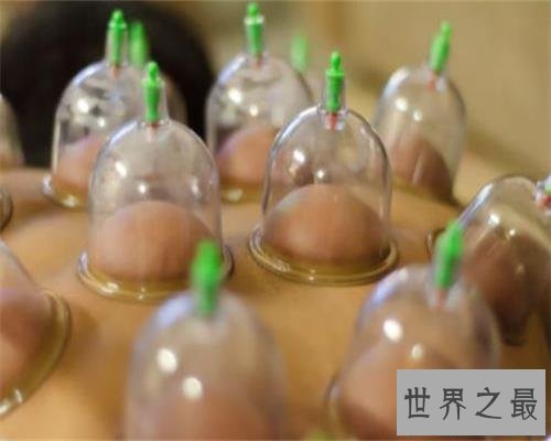 【图】拔罐后皮肤色彩甄别，了解你的瘦弱水平。