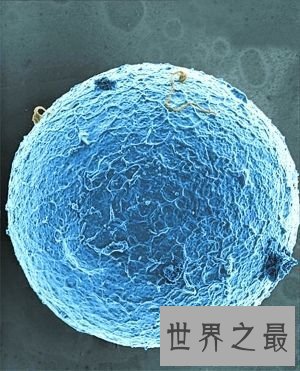 【图】人体最大的细胞，女性卵细胞200微米(肉眼能看见