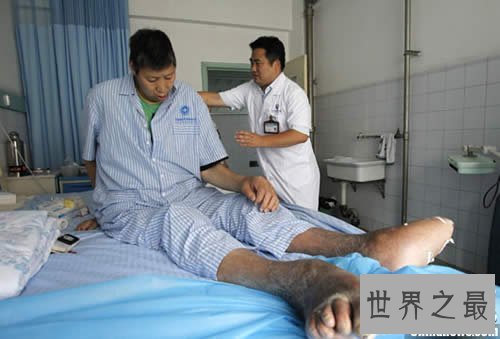 【图】世界上最高的人，清点8个世界最高的人(3.17米)