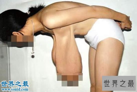 【图】世界上乳房下垂最重大的女人，不断掉到大腿处