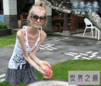 【图】世界上最瘦的人，减肥过度如干尸(只有20公斤)