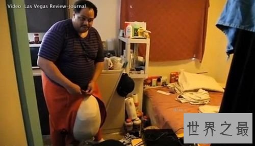 【图】世界上最大的男性生殖器，奇人的丁丁长度达3