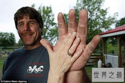【图】世界上最大的人，清点10小孩儿体器官的世界纪录