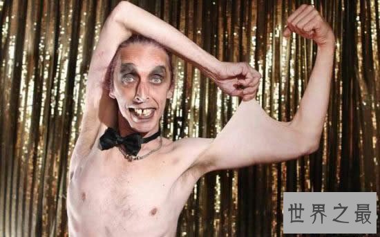 【图】世界上皮肤最有弹性的人，下巴皮肤盖住嘴巴(图