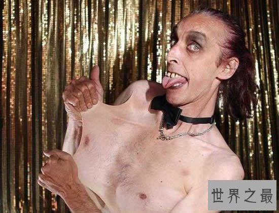 【图】世界上皮肤最有弹性的人，下巴皮肤盖住嘴巴(图