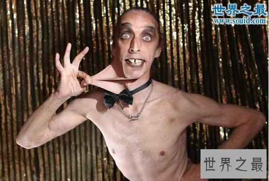 【图】世界上皮肤最有弹性的人，下巴皮肤盖住嘴巴(图