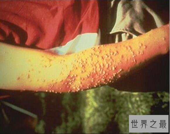 【图】世界上最毒的蚂蚁，红火蚁致人休克而死(附防治